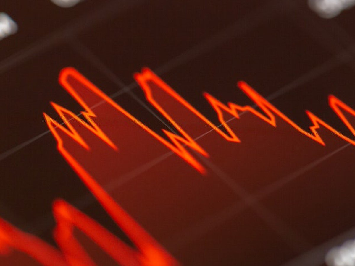 Stock markets decline in early trade after 3-day rally