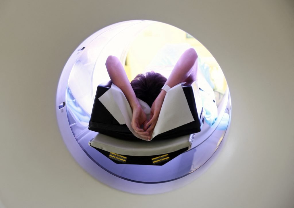 Study shows link between CT scans and the risk of developing cancer