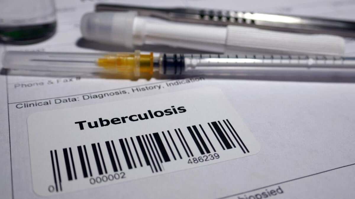 India logged highest number of TB cases in 2024: WHO report